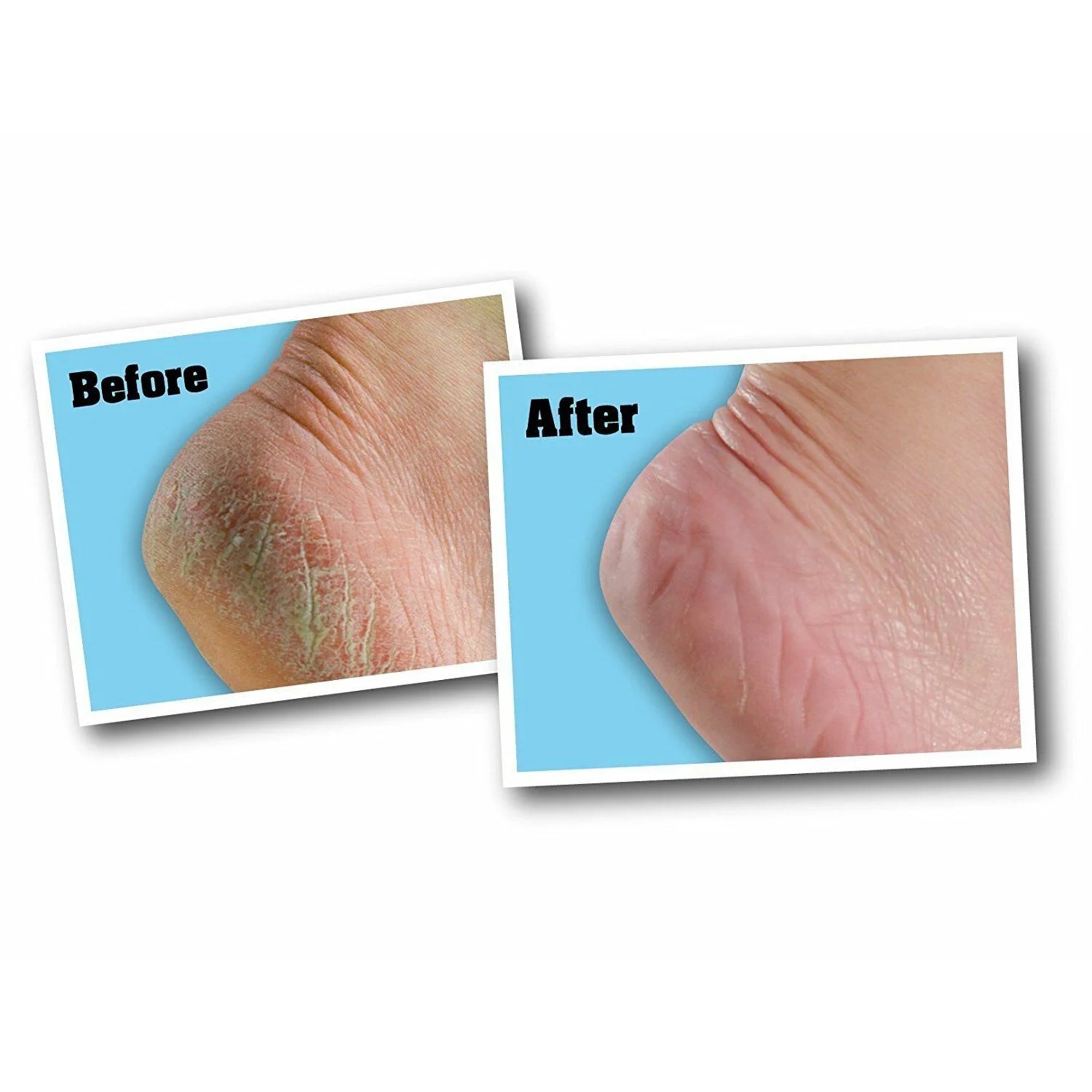 Healthy Feet Foot Cream