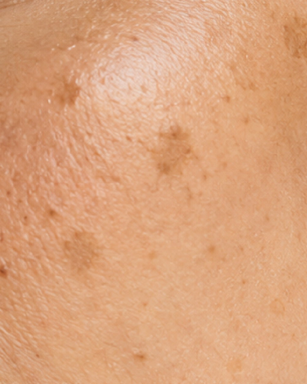Dark Spots
