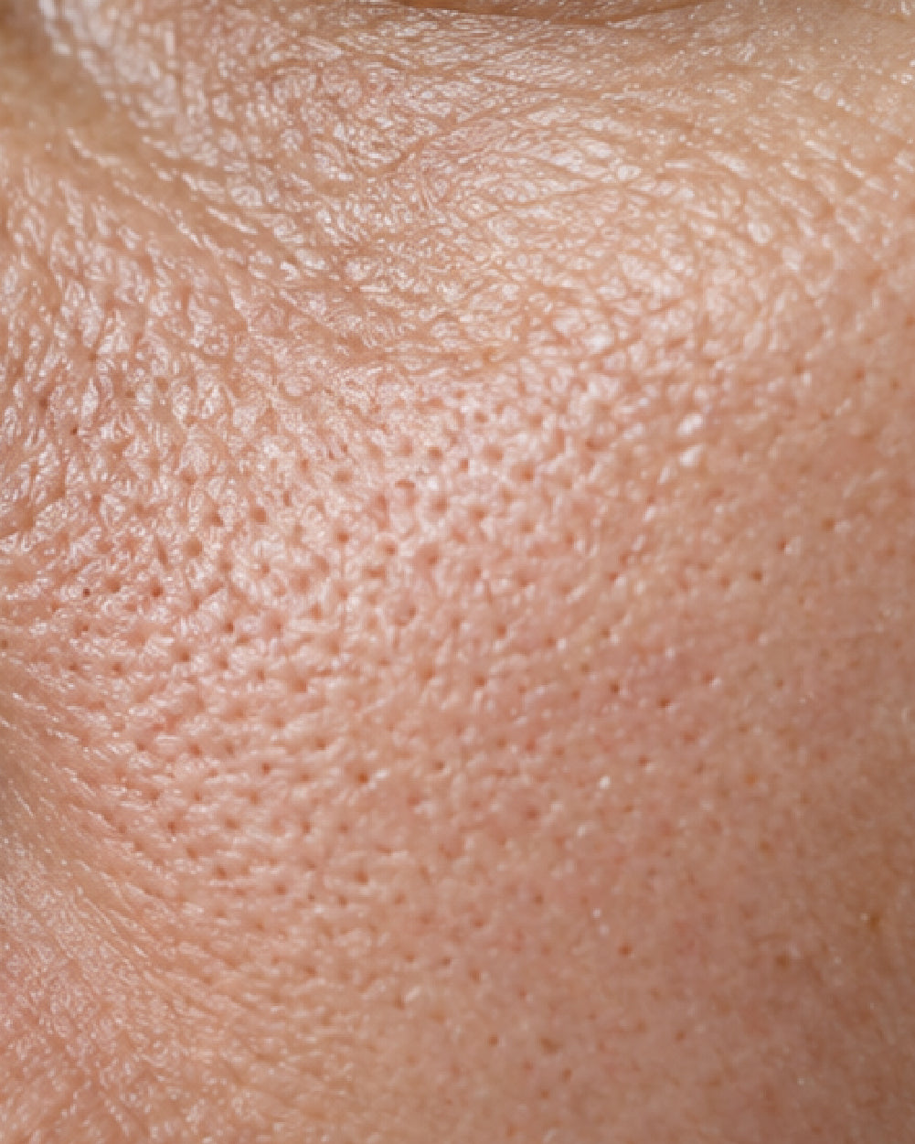 Open Pores