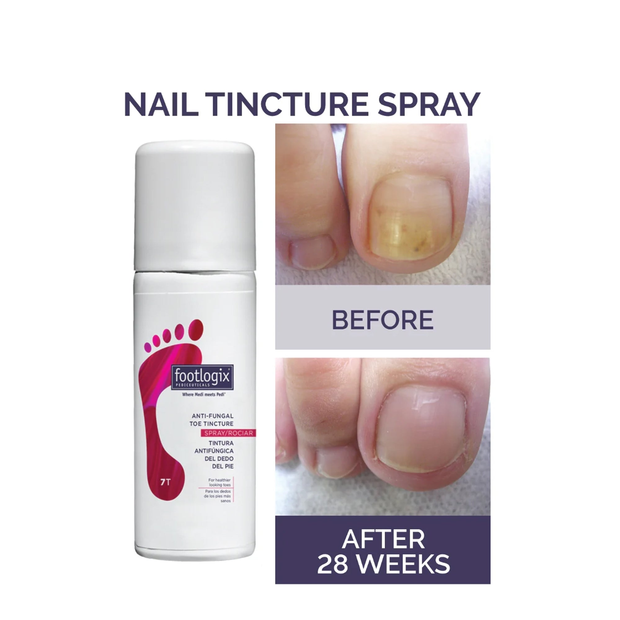 Nail Tincture Spray