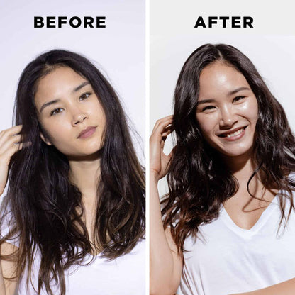 مجموعة جينيسيس فورتيفايينج المضادة لتساقط الشعر