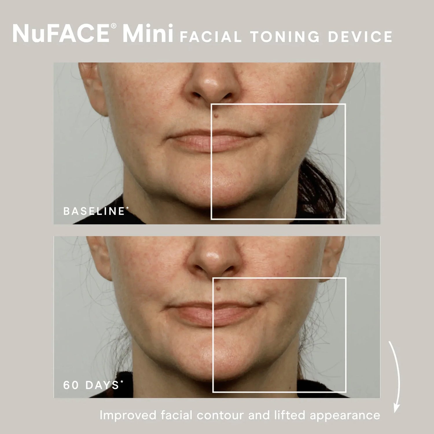 Mini Facial Toning Device