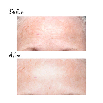 Trinity Wrinkle Reducer Attachment