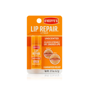 Lip Balm