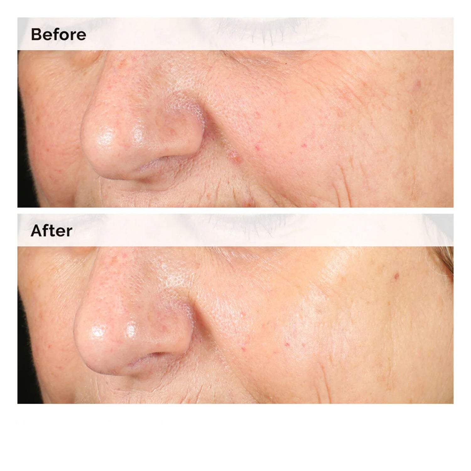 Alpha Arbutin 2% + HA Concentrated Face Serum